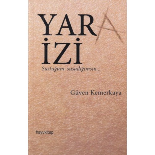 Yara İzi