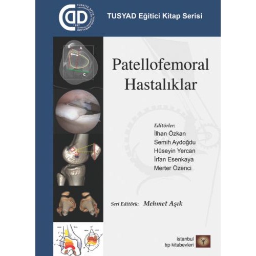 TUSYAD Eğitici Kitap Serisi - Patellofemoral Hastalıklar